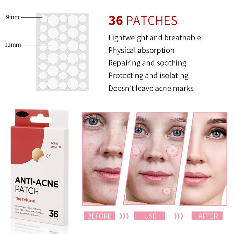 LOGO Anti-Acne Patch (36 Count)